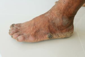 foot_231